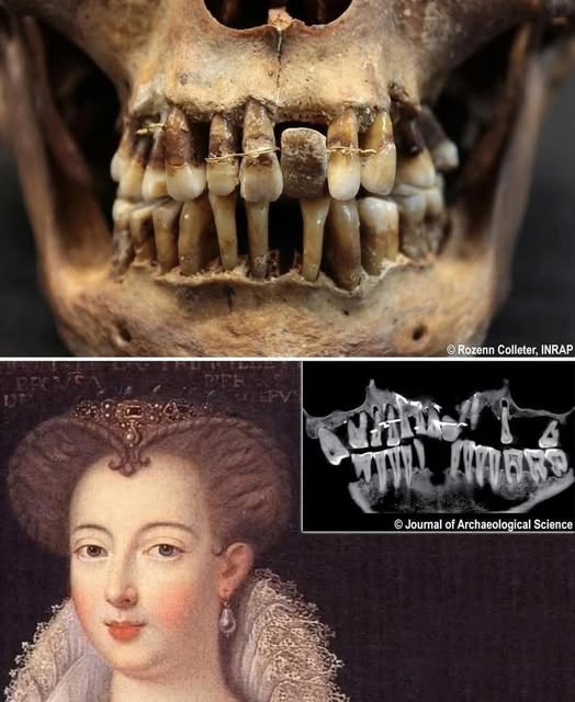 Anne d’Alègre și cel mai dureros zâmbet din Franța secolului al XVII-lea