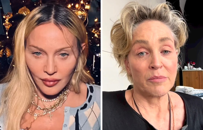 Când intervențiile estetice scapă de sub control, dezastrul este iminent, mai ales la Hollywood