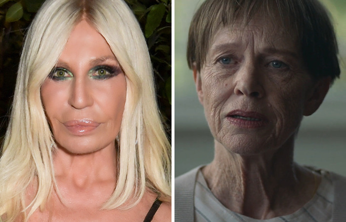 Când intervențiile estetice scapă de sub control, dezastrul este iminent, mai ales la Hollywood