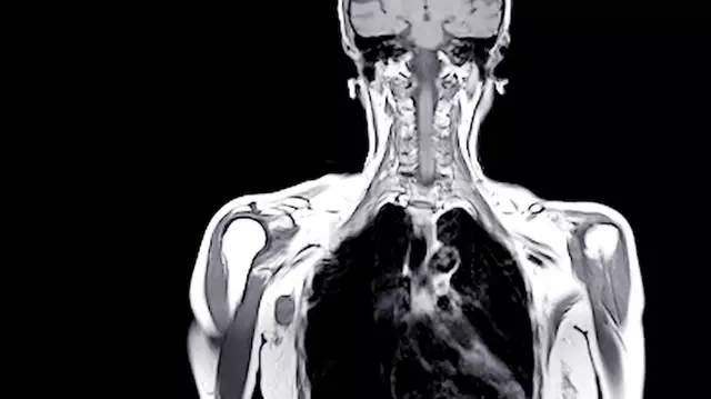O femeie a avut orgasm într-un aparat RMN pentru a arăta ce se întâmplă cu adevărat în corp
