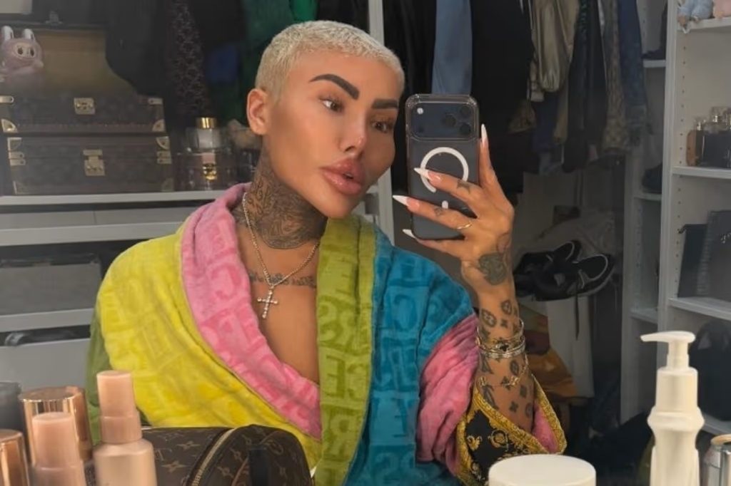 A murit „Regele buzelor”, bărbatul care a cheltuit sume uriașe pentru a semăna cu Kim Kardashian. Povestea dramatică a transformării sale șochează lumea mondenă.
