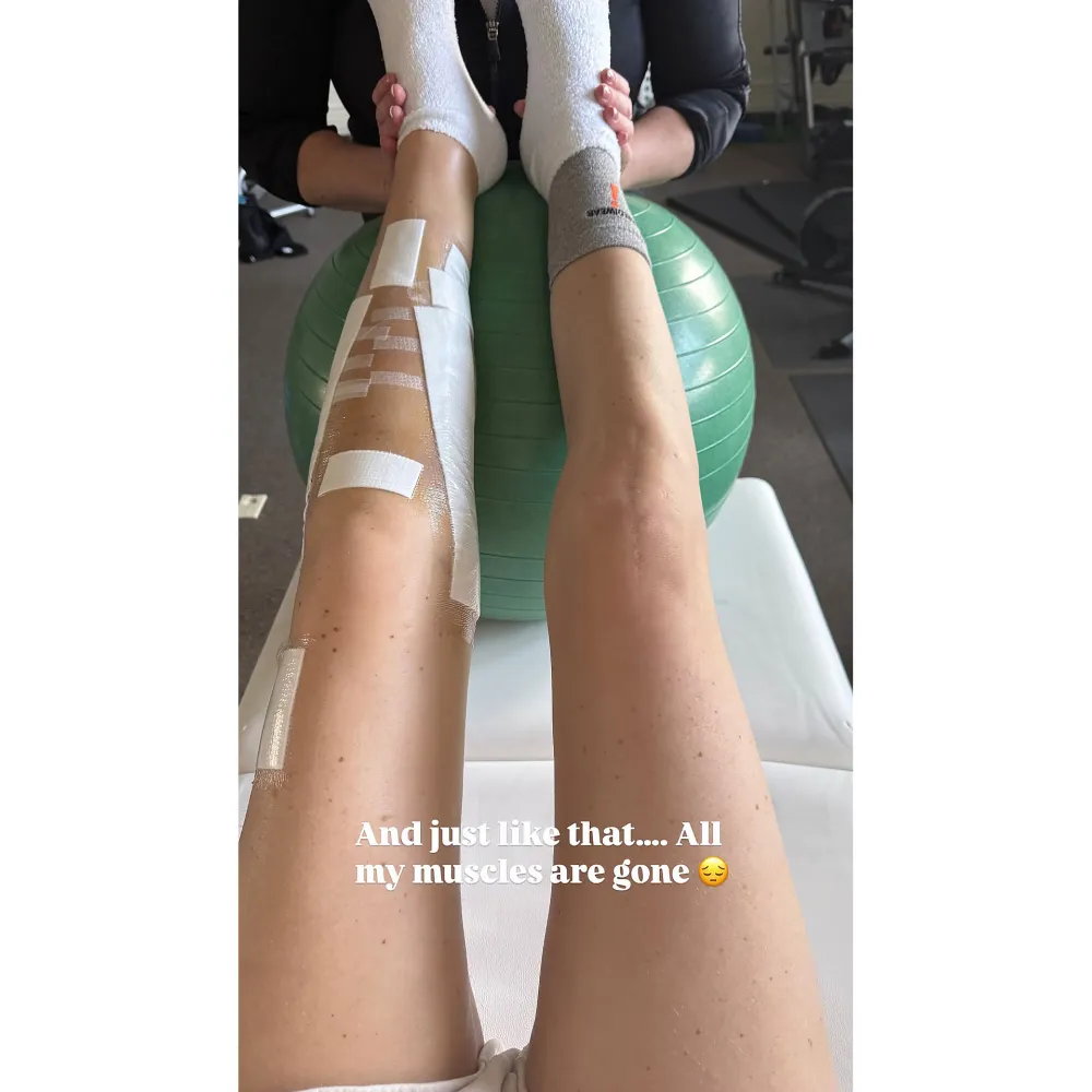 Lindsey Vonn își arată rănile după accidentul de la Jocurile Olimpice: „Mi-au dispărut toți mușchii”